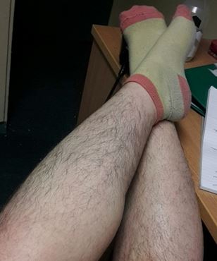 Δείτε την φοιτήτρια που έχει να ξυριστεί 8 χρόνια – ΦΩΤΟ