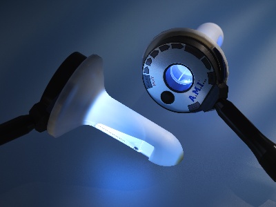 H Ανώδυνη θεραπεία των αιμορροΐδων