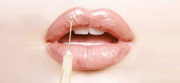 Αυξητική χειλιών- Το μυστικό για φυσικά και σαρκώδη χείλη