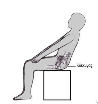 Κύστη κόκκυγος: Ανώδυνο τέλος με ραδιοσυχνότητες