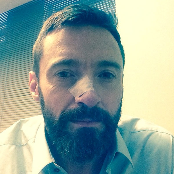 Hugh Jackman: The Moment I Was Told I Had Skin Cancer| Cancer, Coping and Overcoming Illness, Hugh Jackman