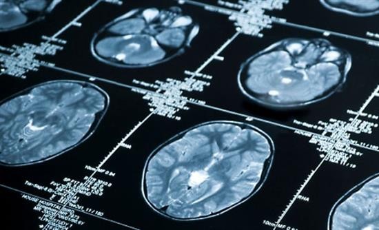 Νέα διαγνωστικά τεστ για τον καρκίνο