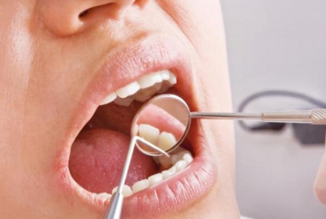 Δείτε τι μπορείτε να πάθετε από ένα χαλασμένο δόντι