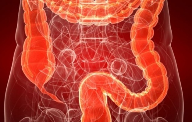 H διατροφή που προλαβαίνει τον καρκίνο του εντέρου