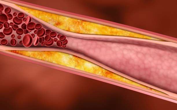 Τέλος εποχής για την χοληστερίνη