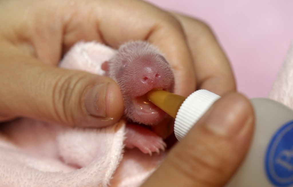 Ουάσιγκτον: Πέθανε ένα από τα δίδυμα πάντα που γεννήθηκαν πρόσφατα