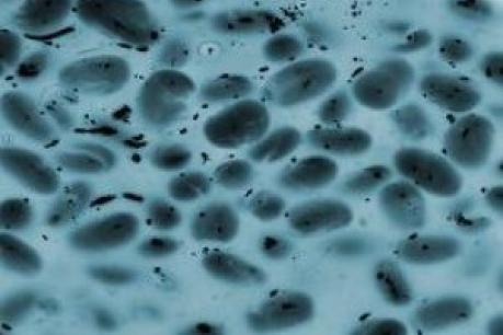 Χιλιάδες μικρόβια κρύβονται στη σκόνη των σπιτιών