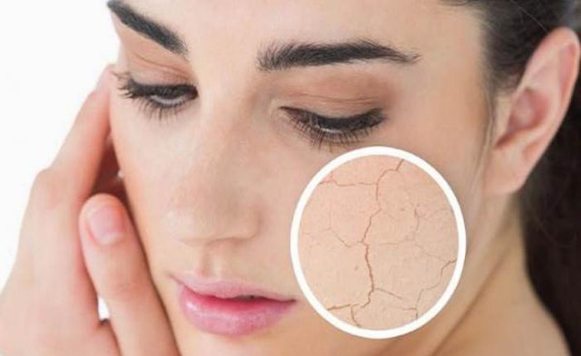 Πώς επηρεάζει ο ήλιος τις παθήσεις του δέρματος