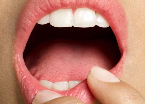 Oδηγίες για τη φροντίδα του στόματος