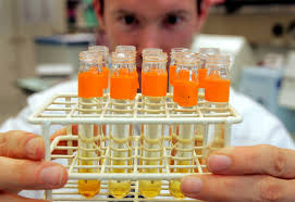 Πειραματικό τεστ ούρων κάνει έγκαιρη διάγνωση του καρκίνου του παγκρέατος