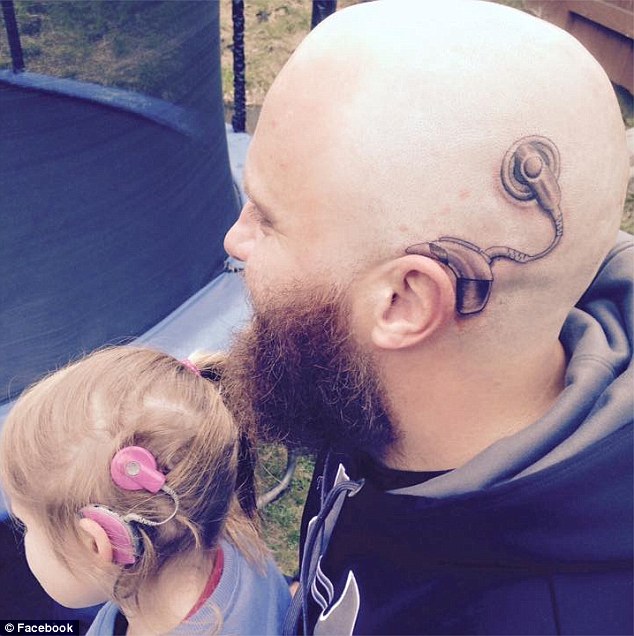 Πατέρας έκανε τατουάζ το εμφύτευμα της κόρης του – ΦΩΤΟ