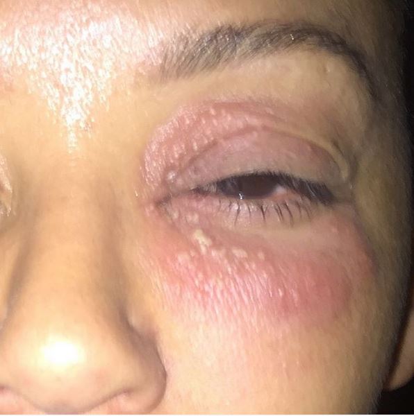 Τι συνέβη στη γνωστή τραγουδίστρια και παραμορφώθηκε; – ΦΩΤΟ