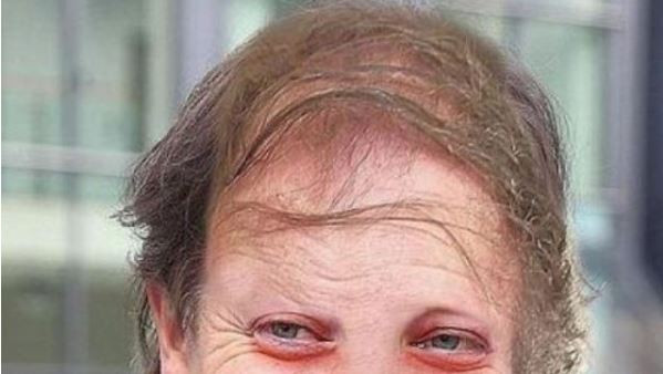 Σοκάρει η εικόνα πασίγνωστου ηθοποιού του Hollywood – ΦΩΤΟ