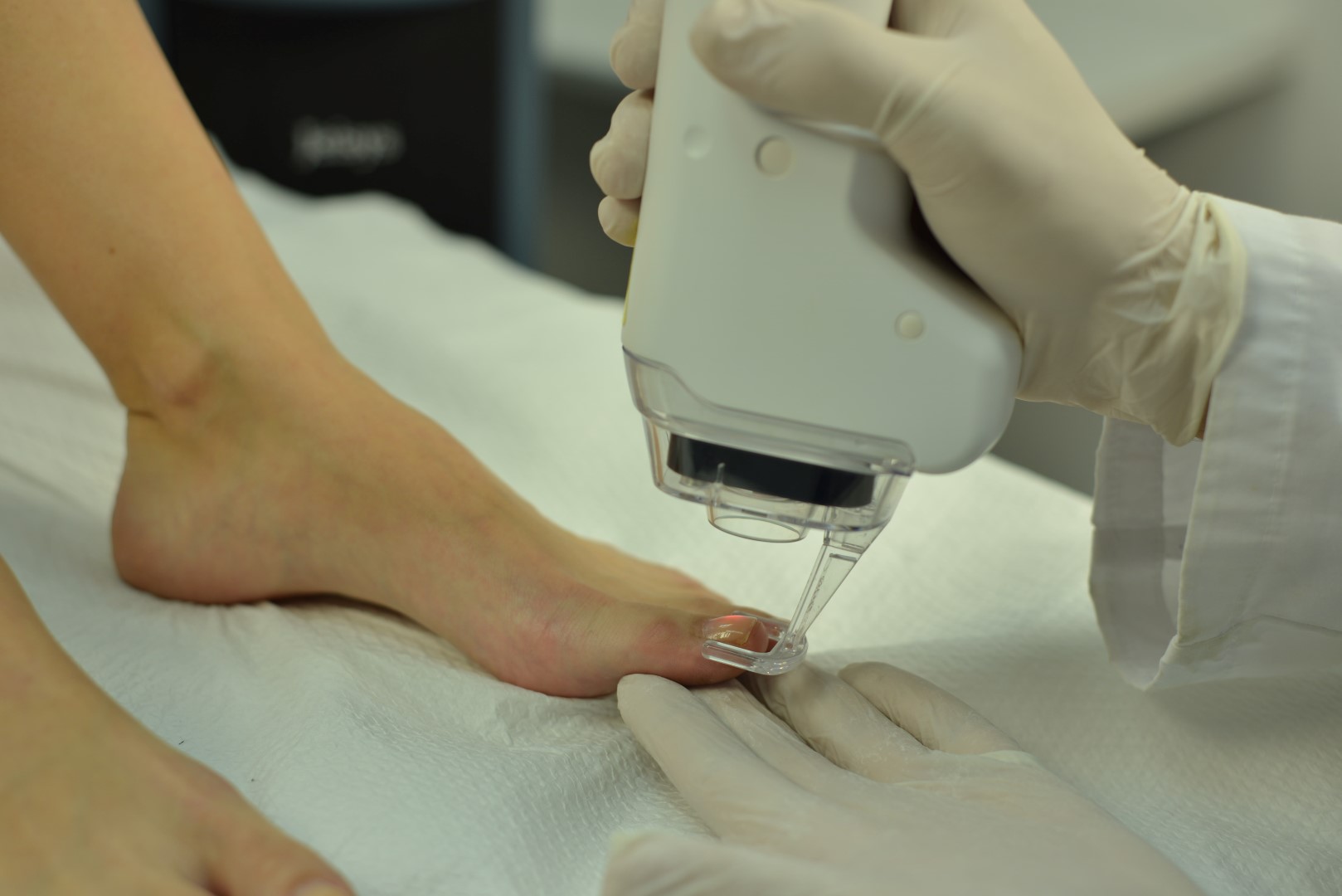 Το καλοκαίρι δεν χρειάζεται να τελειώσει «επώδυνα» με την εμφάνιση μυκήτων στα πόδια