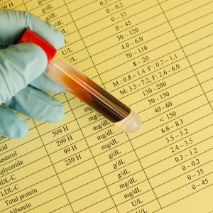 Αυξημένη κακή LDL χοληστερίνη – Γιατί πρέπει να την παρακολουθούμε;