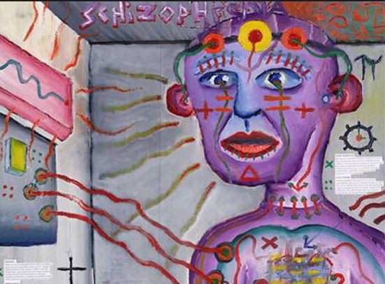 Σχιζοφρένεια – Αυτά είναι τα πρώτα σημάδια της ασθένειας