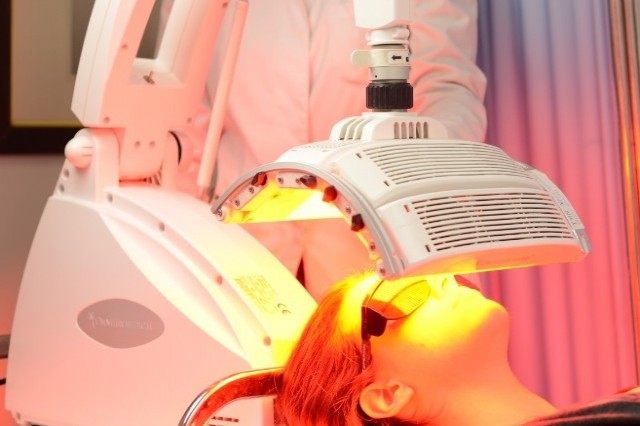 Ακμή και ευαισθησία στον ήλιο – Πώς συνδέονται;