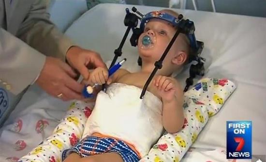 Χειρουργικό θαύμα για αγοράκι 16 μηνών – ΦΩΤΟ