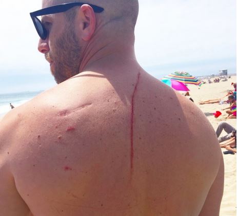 Η επίθεση καρχαρία του έσωσε τη ζωή – ΦΩΤΟ