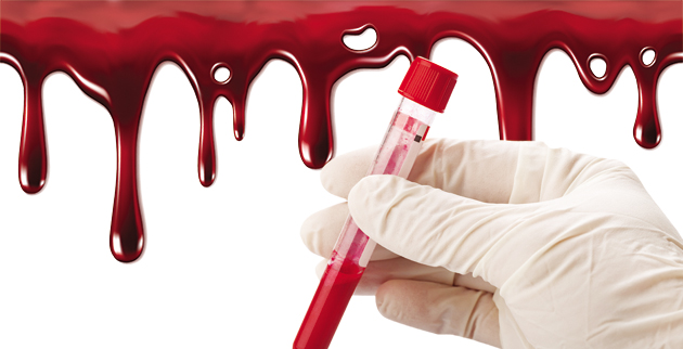 Η «πρωτεΐνη του Δράκουλα»