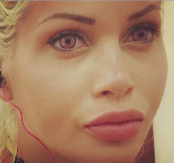 25χρονη αφαίρεσε τα πλευρά της για να μοιάζει με… καρτούν – ΦΩΤΟ