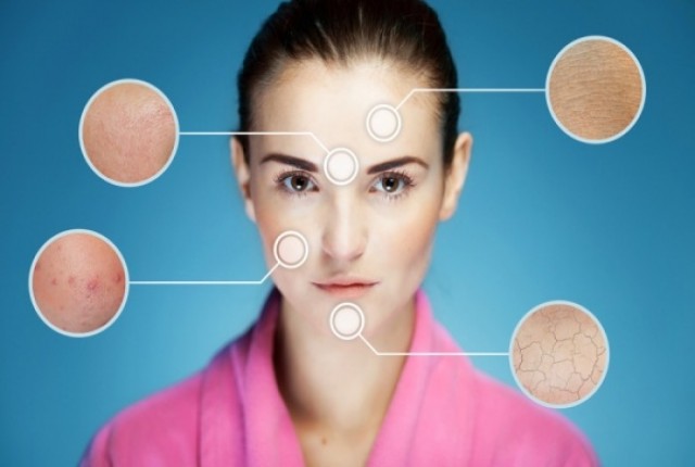 Δερματικά προβλήματα- Αναγνωρίστε τα μέσα από φωτογραφίες