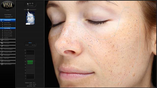 Ανακαλύψτε την αληθινή ηλικία του δέρματός σας