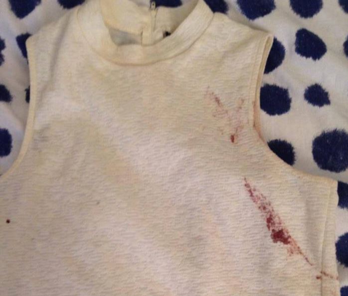 Το ανατριχιαστικό μήνυμα της 22χρονης που επέζησε στο Μπατακλάν – ΦΩΤΟ