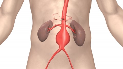 Ανεύρυσμα Κοιλιακής Αορτής: Τι ακριβώς είναι και πώς αντιμετωπίζεται