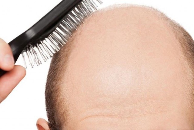 Βλαστοκύτταρα εναντίον της τριχόπτωσης