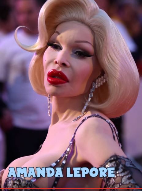 Οι 10 πιο αποτυχημένες πλαστικές επεμβάσεις διασήμων – ΒΙΝΤΕΟ