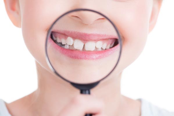 Στραβά δόντια στο παιδί- Οι 3 παράγοντες που τα προκαλούν