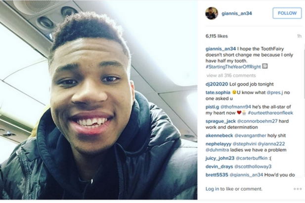 Το σπασμένο δόντι του Αντετοκούνμπο – ΒΙΝΤΕΟ-ΦΩΤΟ