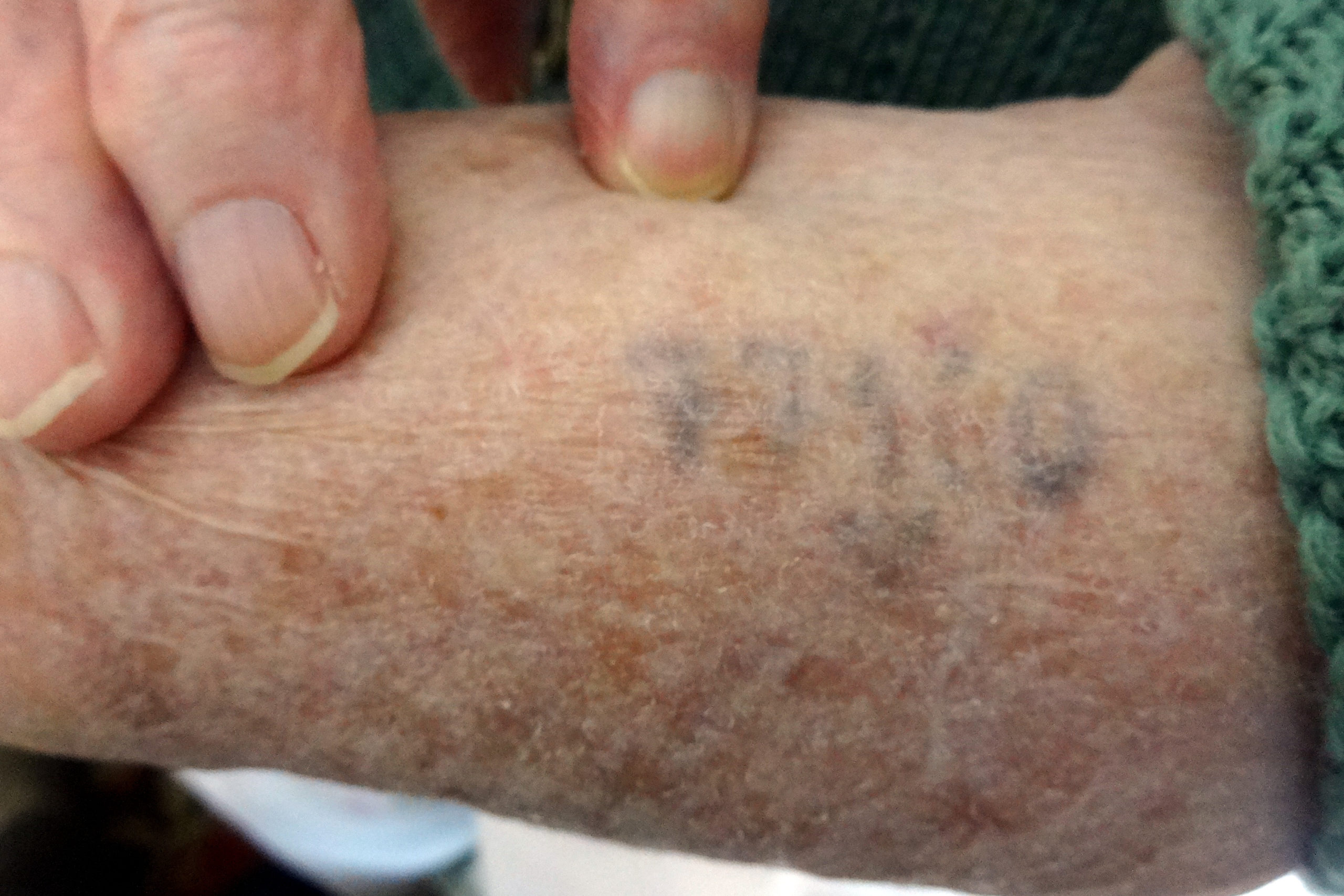 Η εξόντωση των Εβραίων των Ιωαννίνων – Μια συγκλονιστική αφήγηση της θηριωδίας- ΦΩΤΟ