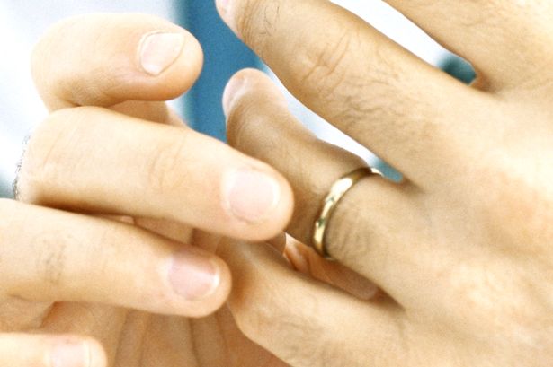 Κάλεσε την πυροσβεστική για να βγάλει την… βέρα του