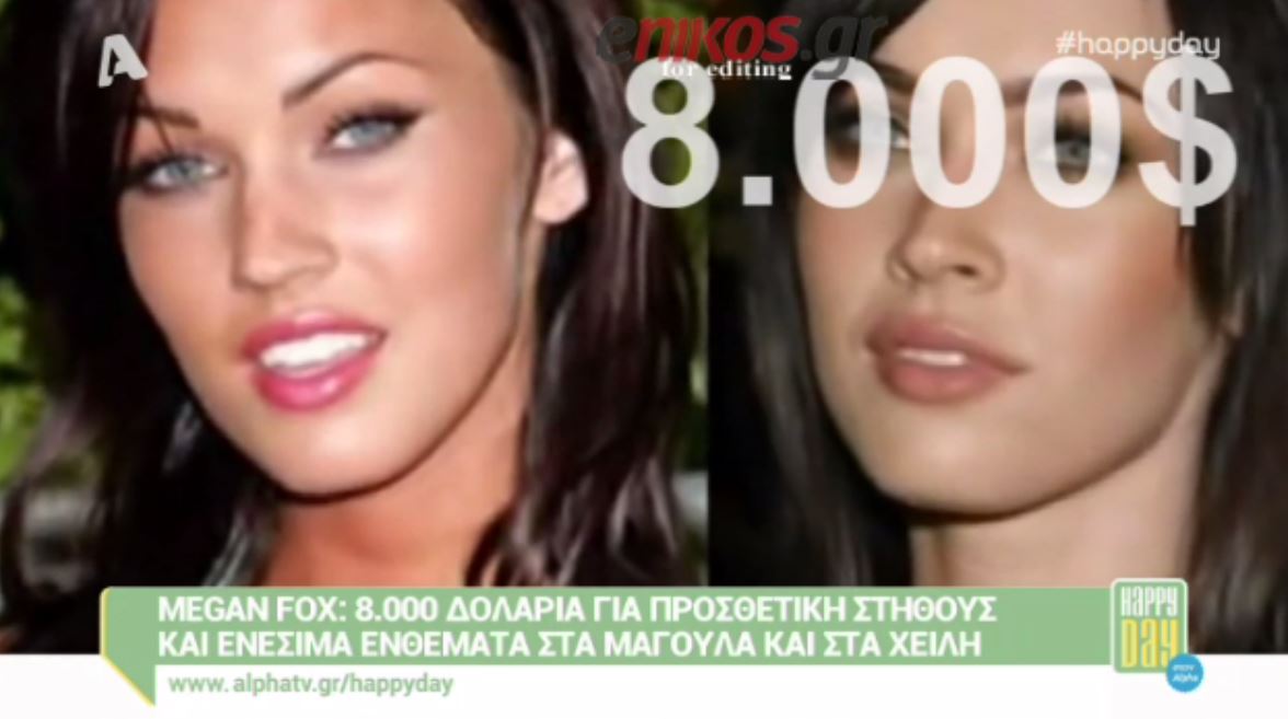 Οι πιο ακριβοπληρωμένες πλαστικές επεμβάσεις των celebrities – ΒΙΝΤΕΟ