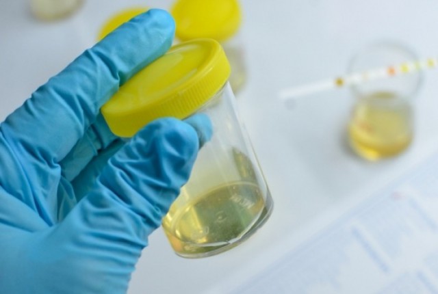 Μυρωδιά των ούρων: Ποια σοβαρή ασθένεια “προδίδει”;