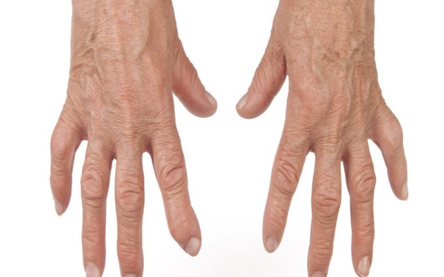 Ρευματοειδής αρθρίτιδα και διατροφή