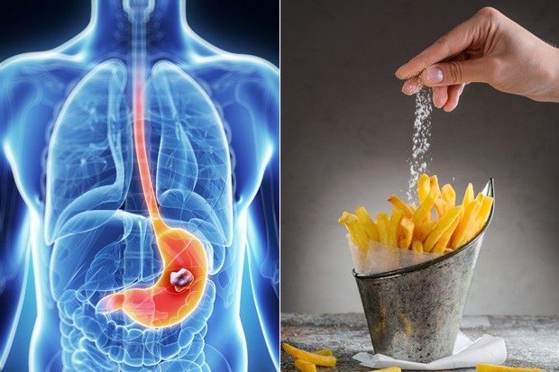 8 τρόποι για να περιορίσεις το αλάτι