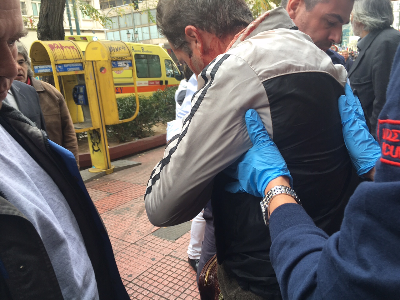 Άγνωστοι χτύπησαν δημοσιογράφο στην Πατησίων – ΦΩΤΟ- ΤΩΡΑ