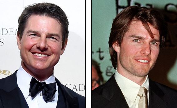 Τι συνέβη στο πρόσωπο του Τομ Κρουζ; – ΦΩΤΟ