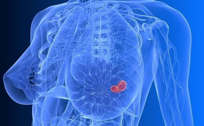 Χρήσιμος οδηγός Ψηφιακής Μαστογραφίας για όλες τις γυναίκες