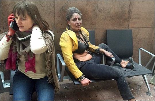 Ποια είναι η τραυματισμένη γυναίκα που συγκλόνισε το διαδίκτυο – ΦΩΤΟ