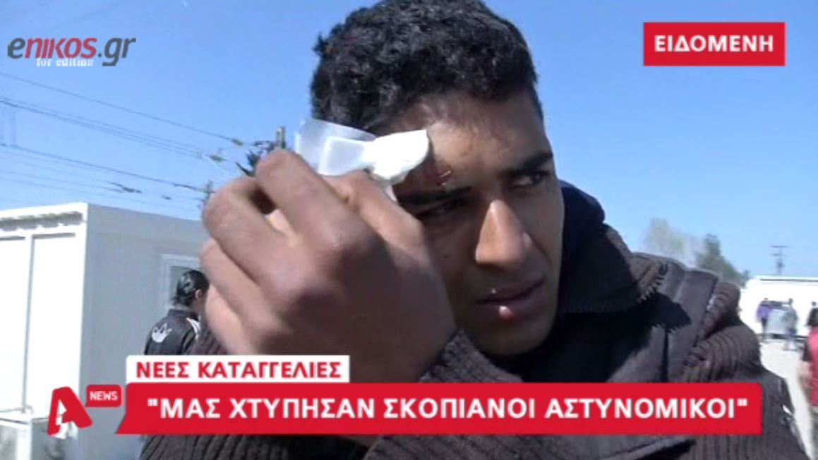 “Οι Σκοπιανοί μου έσπασαν το χέρι” – ΒΙΝΤΕΟ