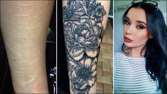 22χρονη κάνει δωρεάν τατουάζ… σε ανθρώπους με ουλές – ΦΩΤΟ