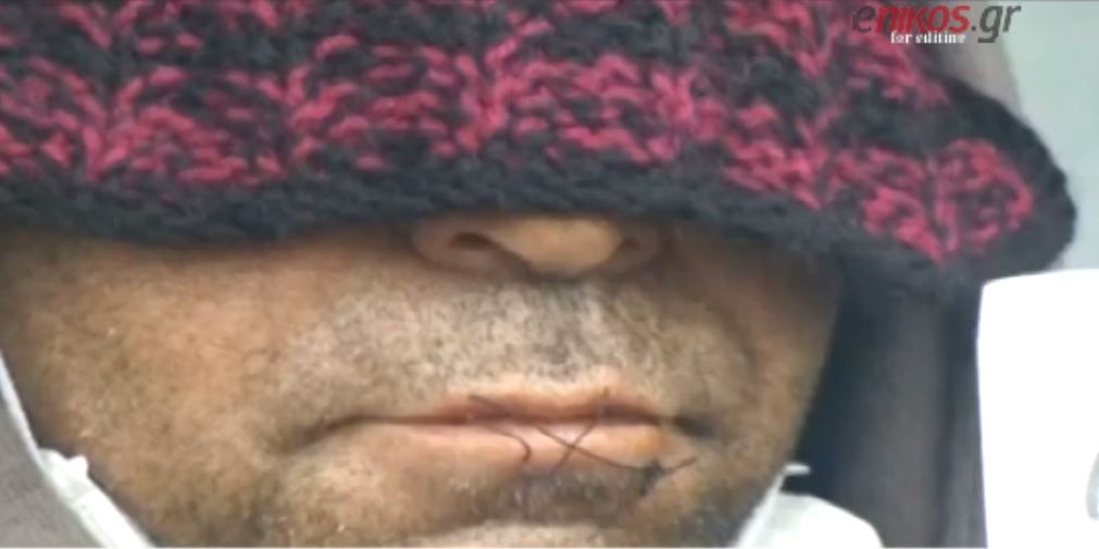 Μετανάστες στο Καλαί έραψαν τα στόματά τους – ΒΙΝΤΕΟ