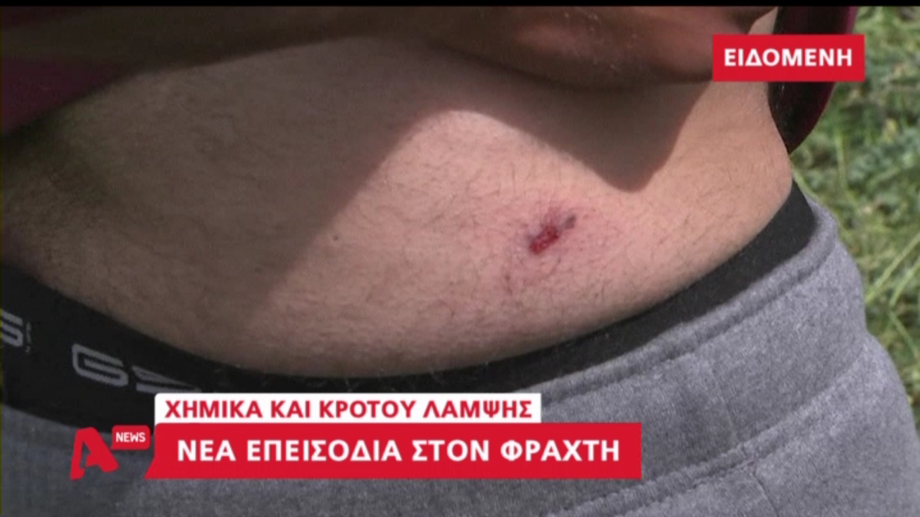 Νέο ΒΙΝΤΕΟ από τα επεισόδια στην Ειδομένη