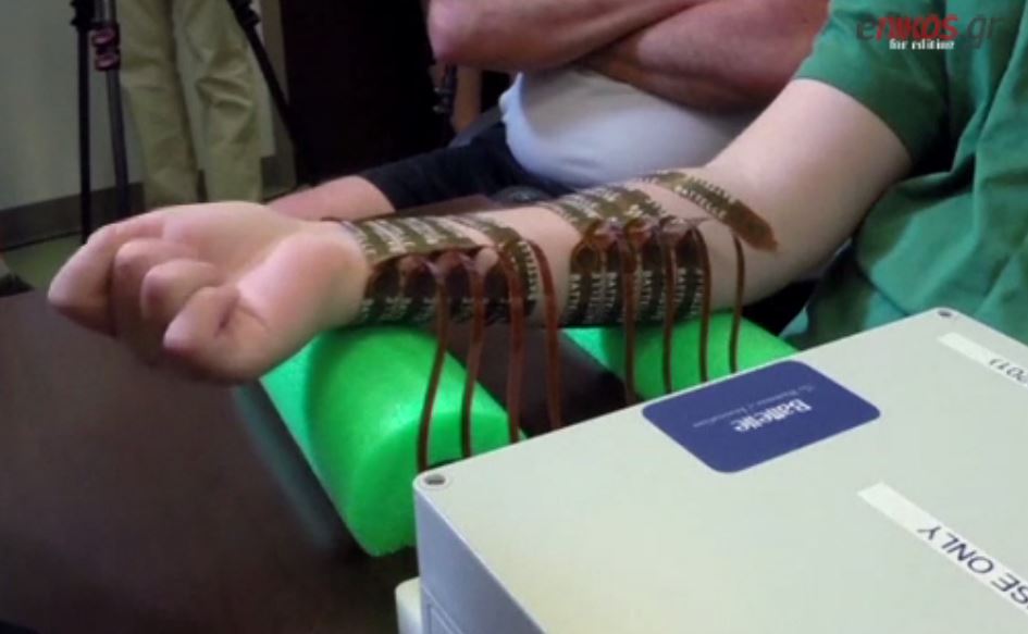 Κουνά το χέρι του με τη δύναμη της σκέψης – ΒΙΝΤΕΟ