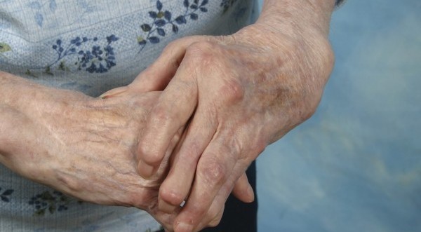 Σαρκοπενία: Η πάθηση που ταλαιπωρεί 20 εκατ. Ευρωπαίους