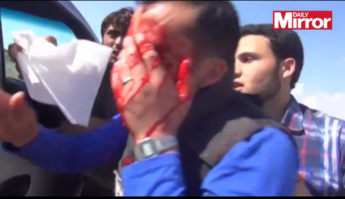 Συγκλονιστικό ΒΙΝΤΕΟ – Δημοσιογράφος τραυματίστηκε κατά τη διάρκεια ζωντανής μετάδοσης από τη Συρία